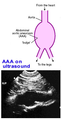 AAA diagram